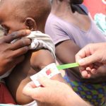 A un niño le miden el contorno del brazo en el Sur de África  Foto WORLD VISION/ Europa Press