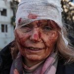 Una mujer herida fue retratada luego de un ataque aéreo ruso contra un complejo de apartamentos en las afueras de Chuguev Ucrania. (Agencia Anadolu)